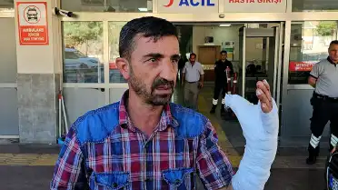 Şanlıurfa'da Kurban Kesimi Sırasında 232 Kişi Yaralandı