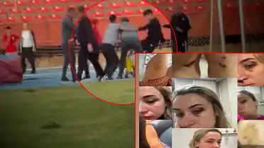 Zonguldak'ta Eski Eşine Şiddet Uygulayan Kişiye Kardeşi Tarafından Saldırı