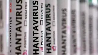 MV Hondius Gemisinde Hantavirüs Salgını: 3 Can Kaybı ve Kayıp Numuneler